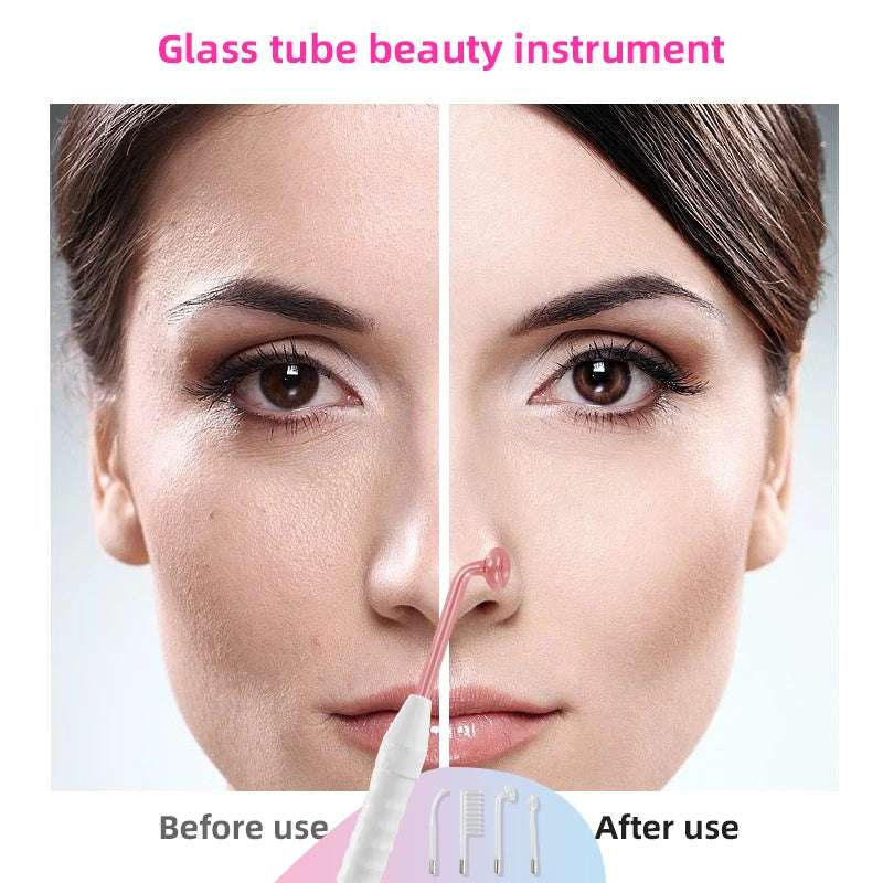 High Frequency Facial and Hair Machine Electrotherapy Wand Neon