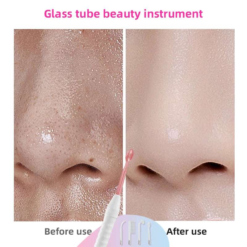 High Frequency Facial and Hair Machine Electrotherapy Wand Neon